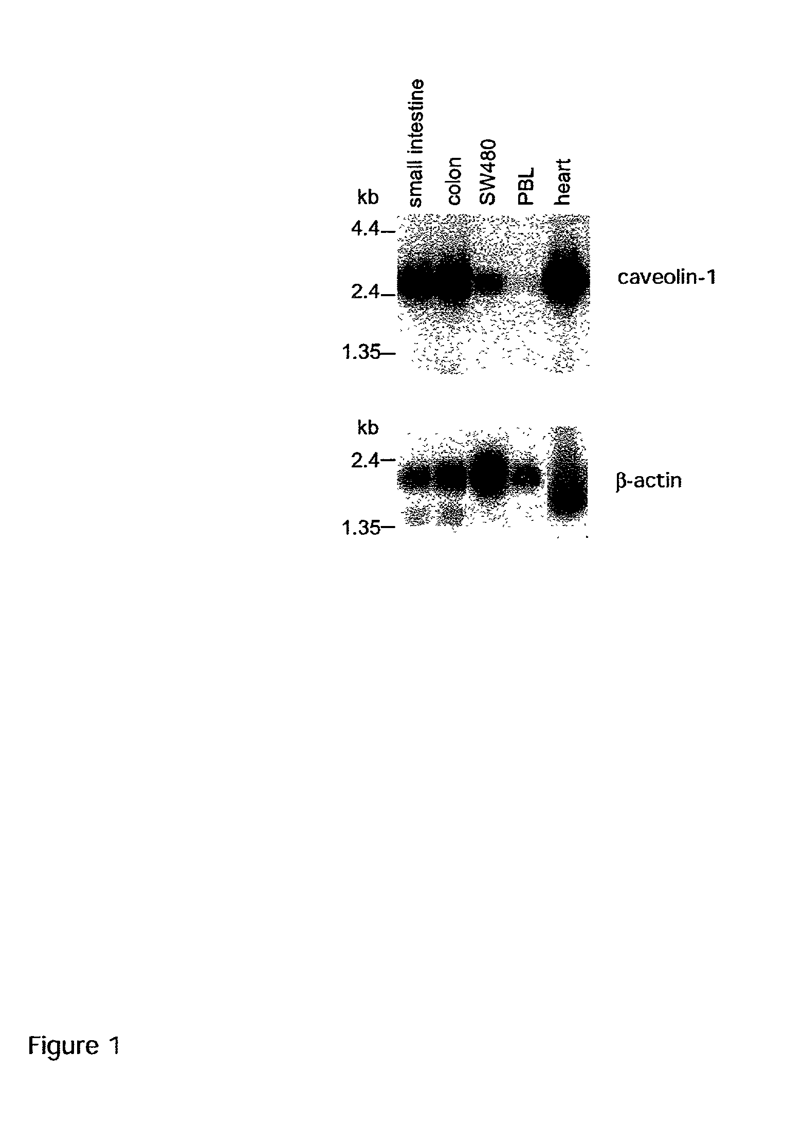 Caveolin-1 gene and polypeptide encoded thereby and methods of use thereof