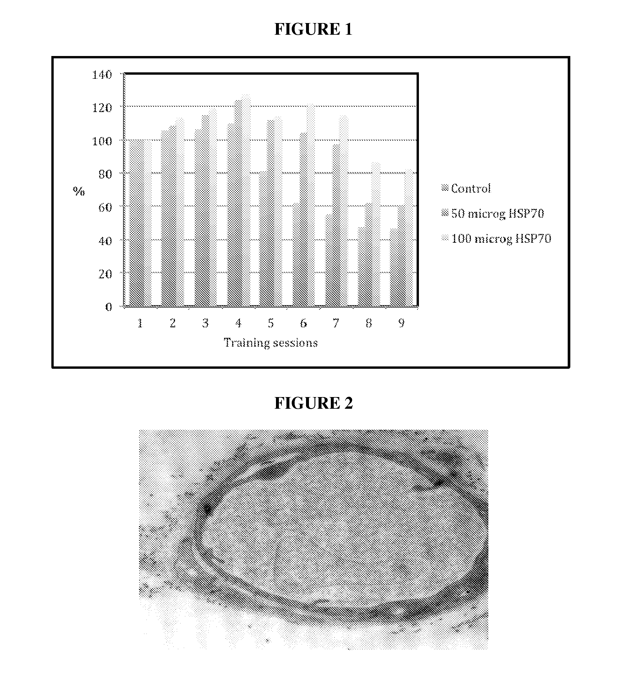 Novel methods of use of hsp70 for increased performance or treatment of hsp70 related disorders