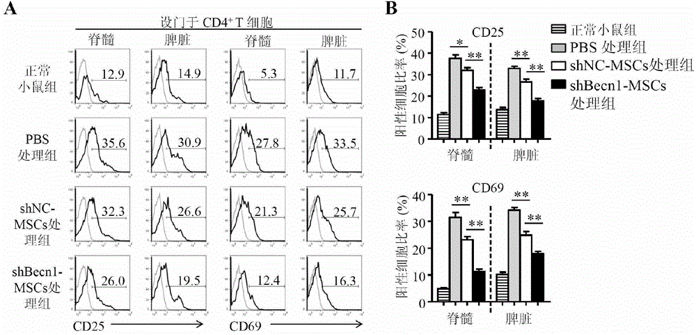 Application of inhibiting autophagy of mesenchymal stem cell in autoimmune disease