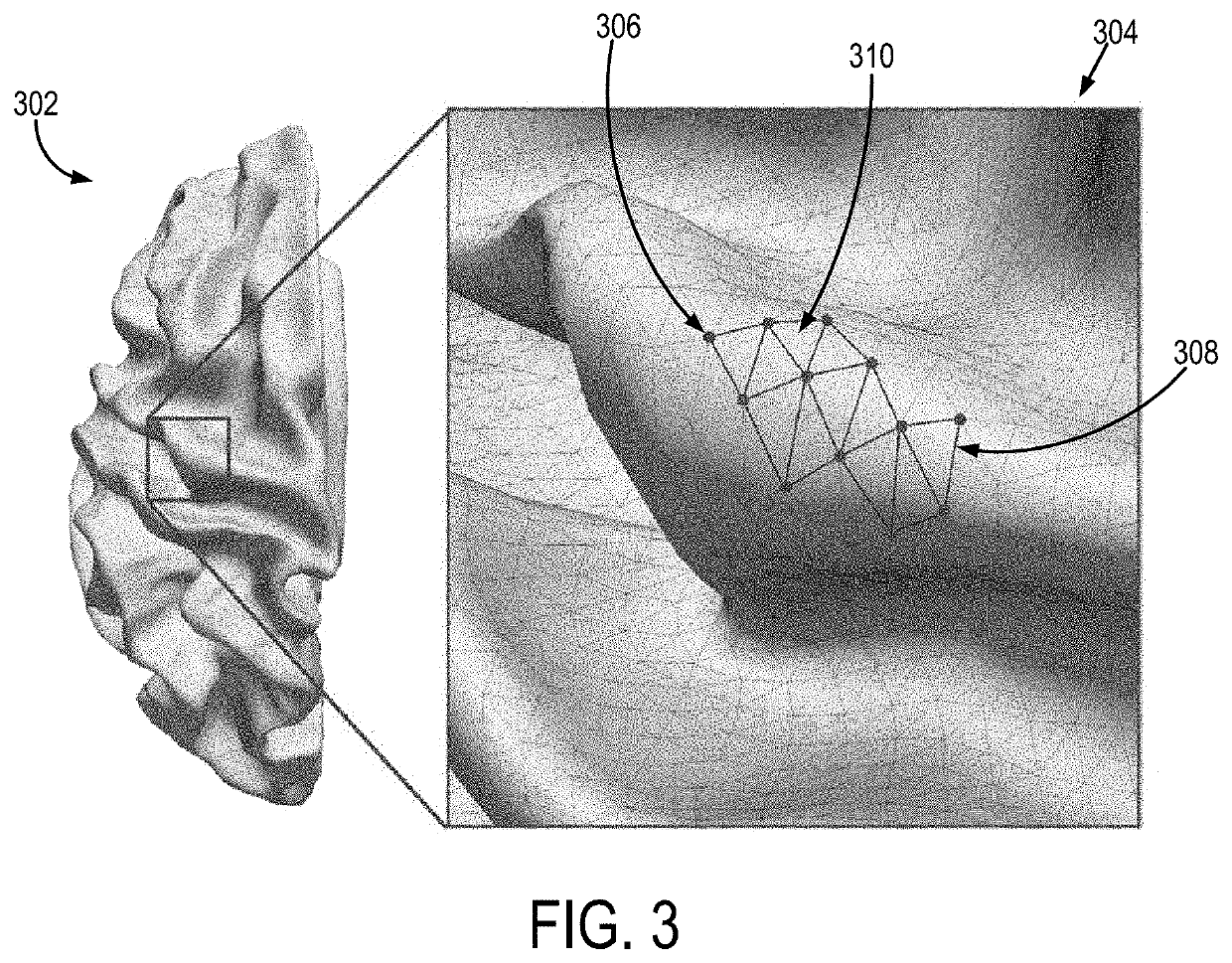 Brain feature prediction using geometric deep learning on graph representations of medical image data