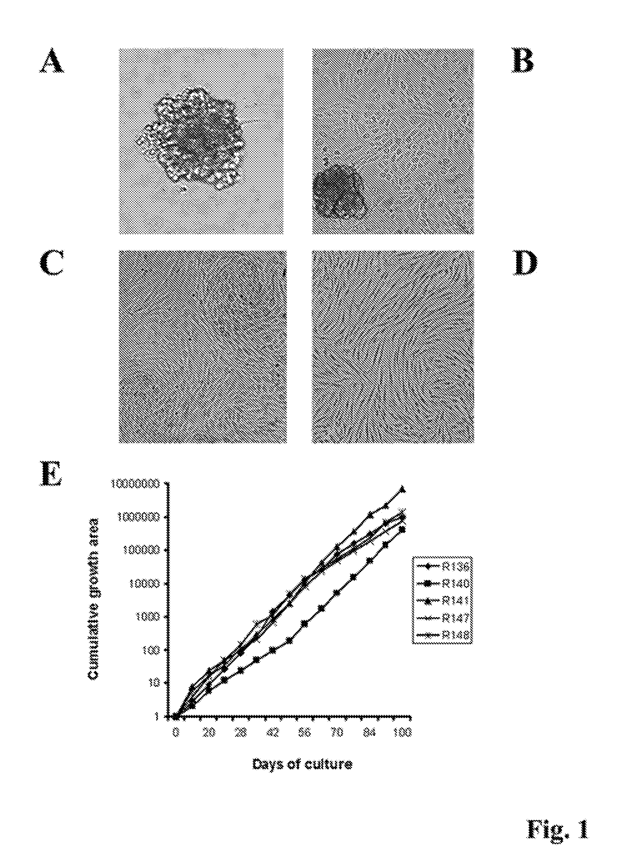 Isolated multipotent mesenchymal stem cell from human adult glomeruli (hgl-msc), a method of preparing thereof and uses thereof in the regenerative medicine of the kidney