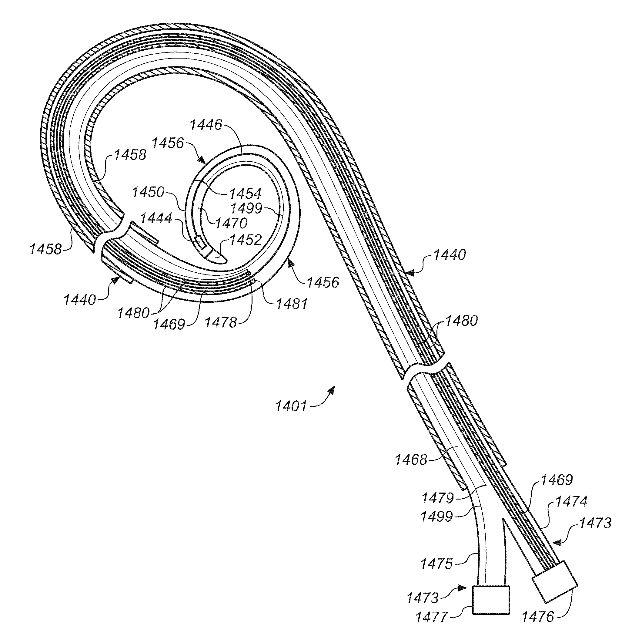 Diagnostic catheters, guide catheters, visualization devices and chord manipulation devices, and related kits and methods