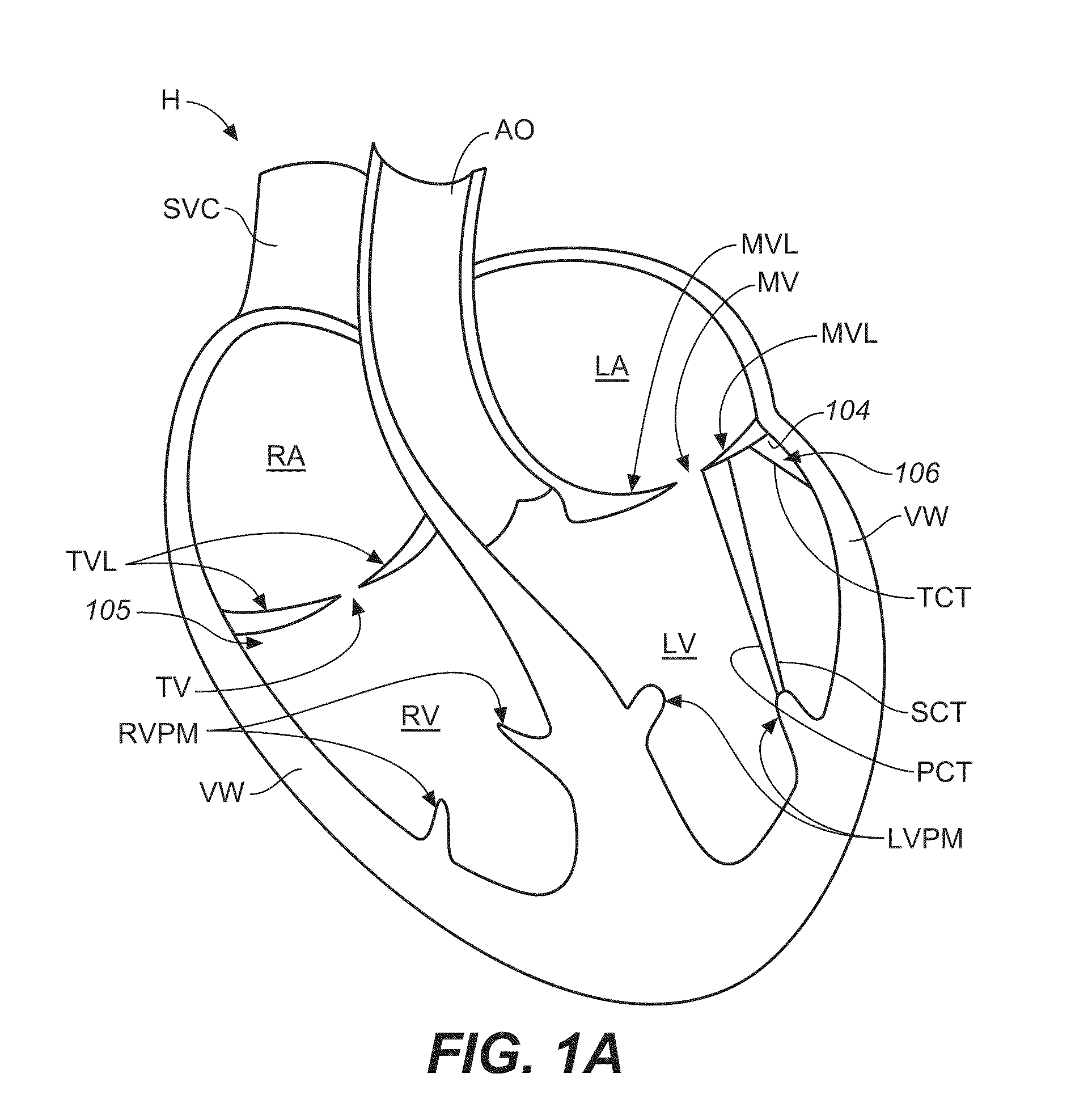 Diagnostic catheters, guide catheters, visualization devices and chord manipulation devices, and related kits and methods