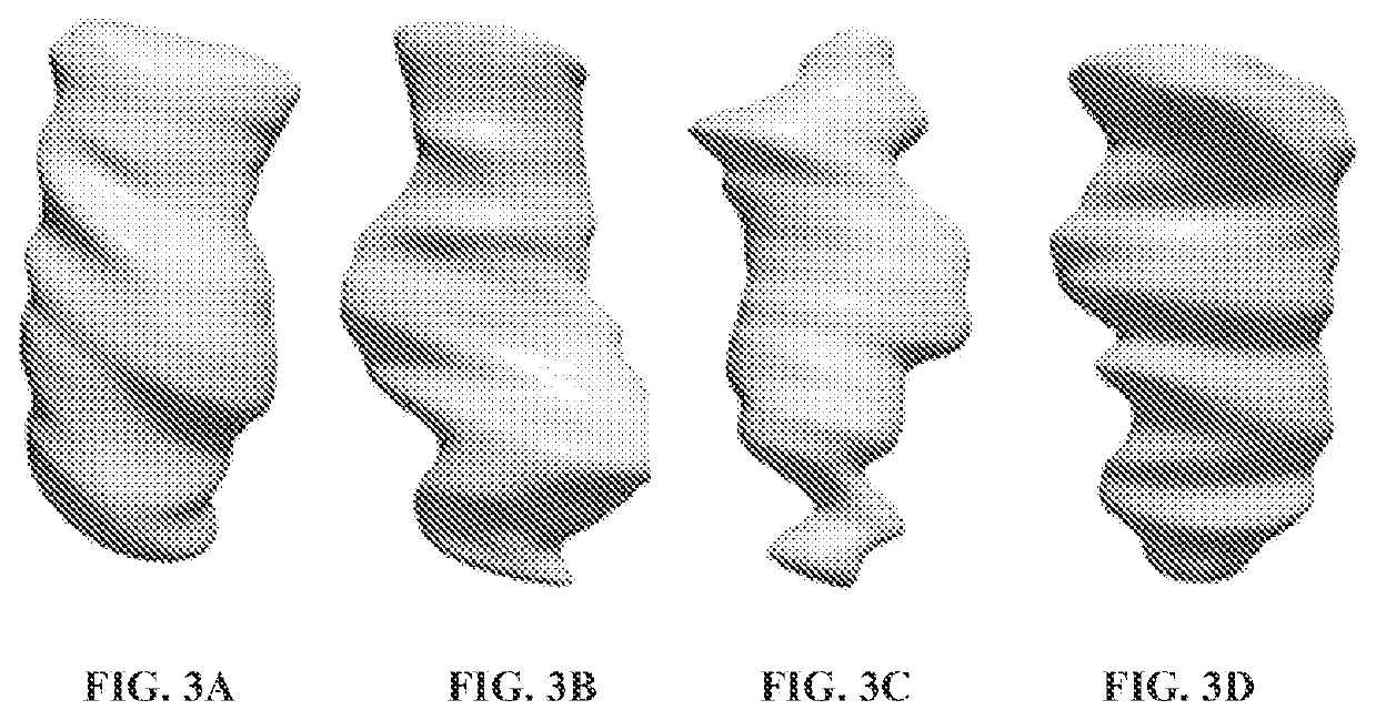 Systems and methods for detecting intracranial pressure and volume