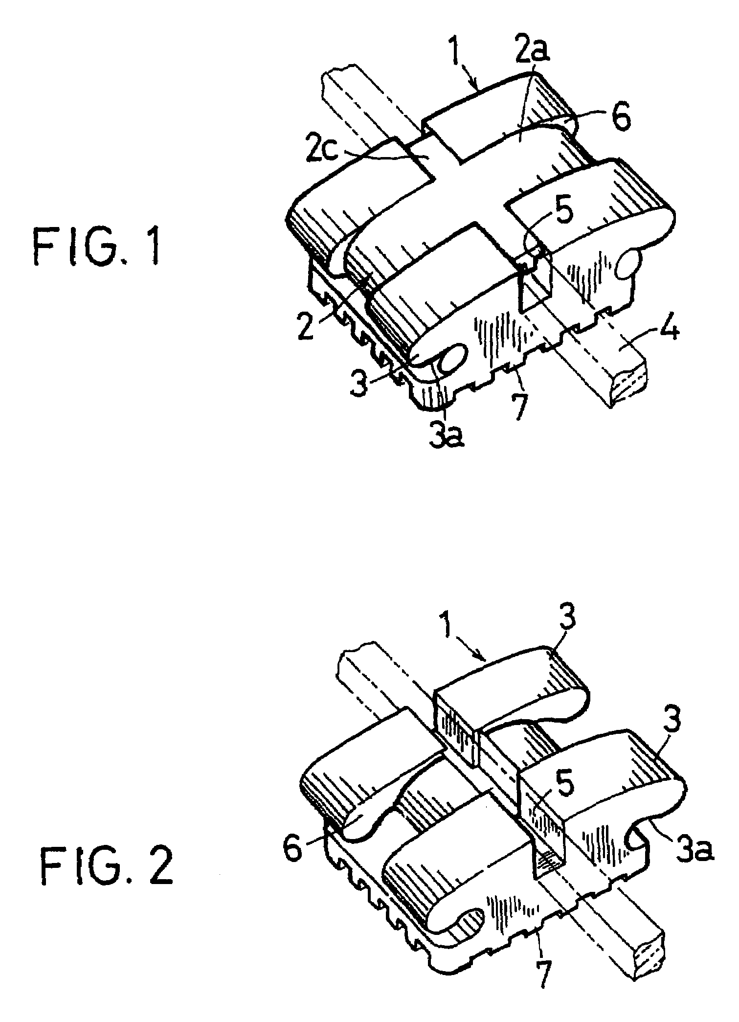 Orthodontic wire ligating member