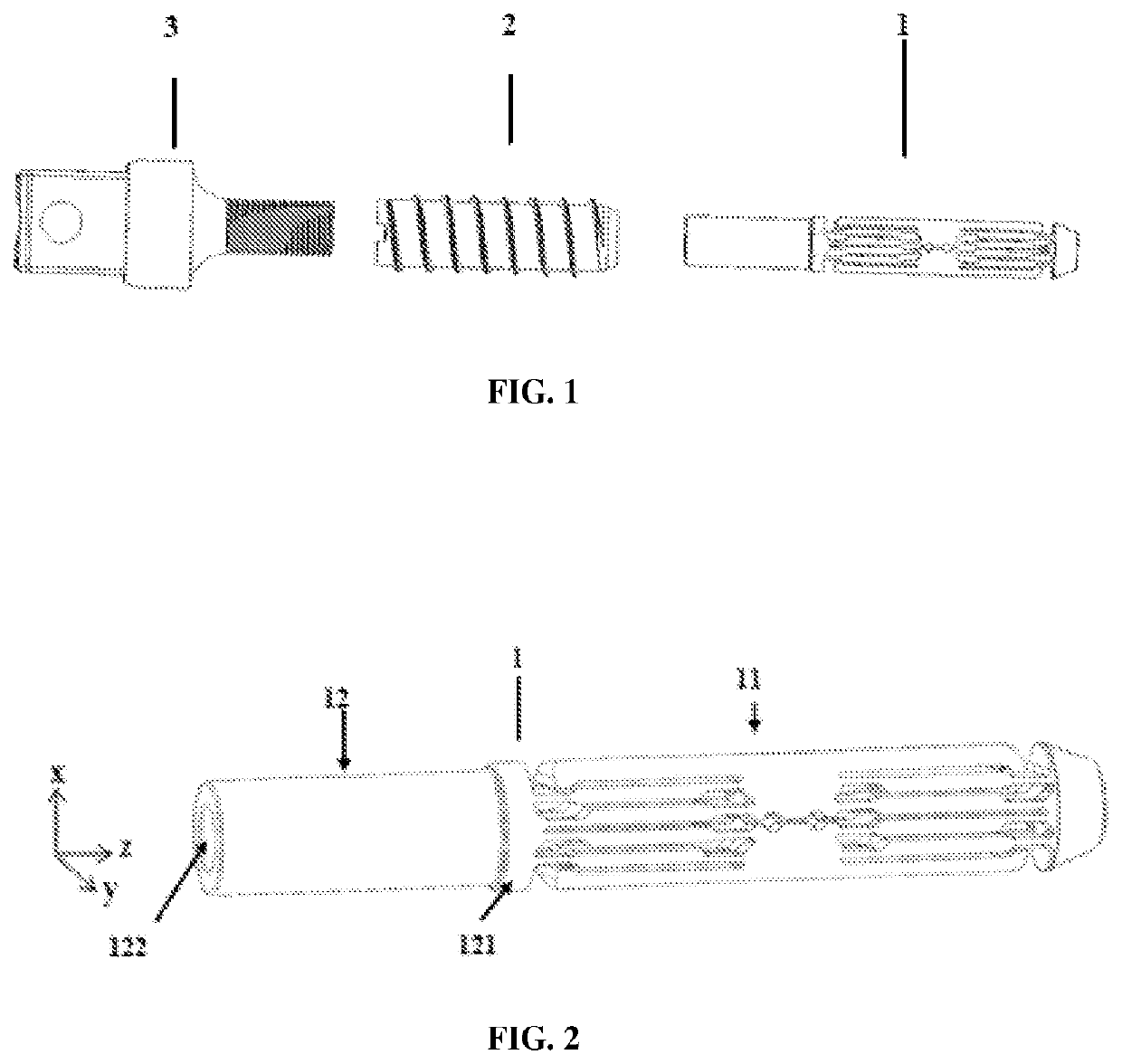 Expansible intravertebral implant system with posterior pedicle fixation