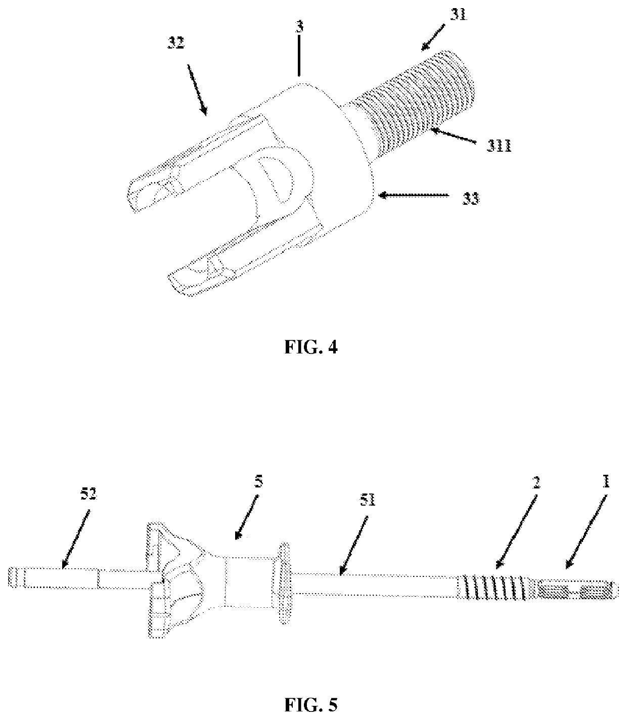 Expansible intravertebral implant system with posterior pedicle fixation