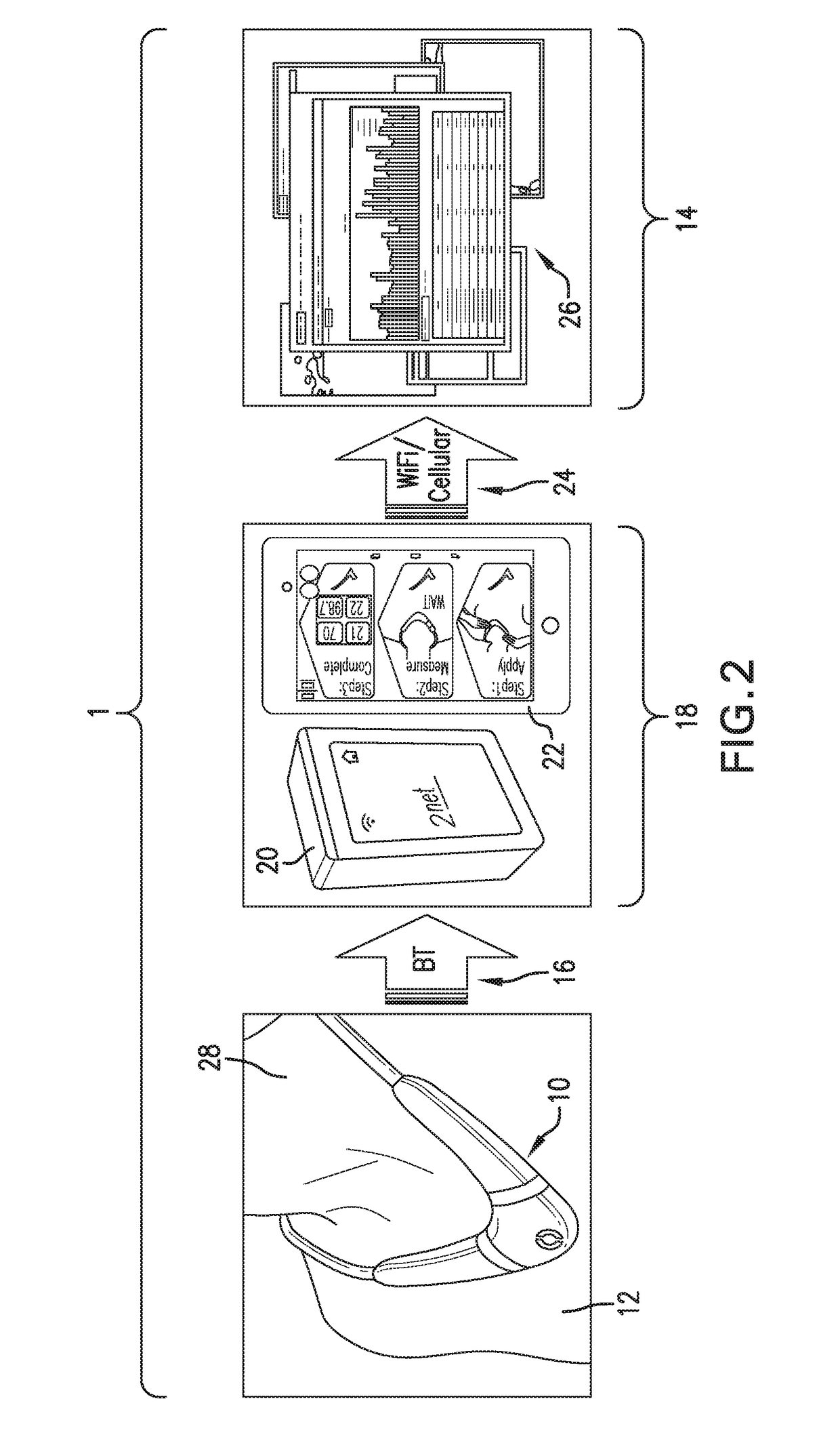 Neck-worn physiological monitor