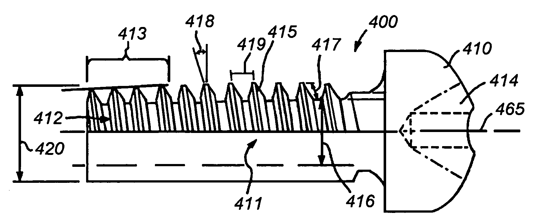 All-metal thread locking/prevailing torque threaded fastener