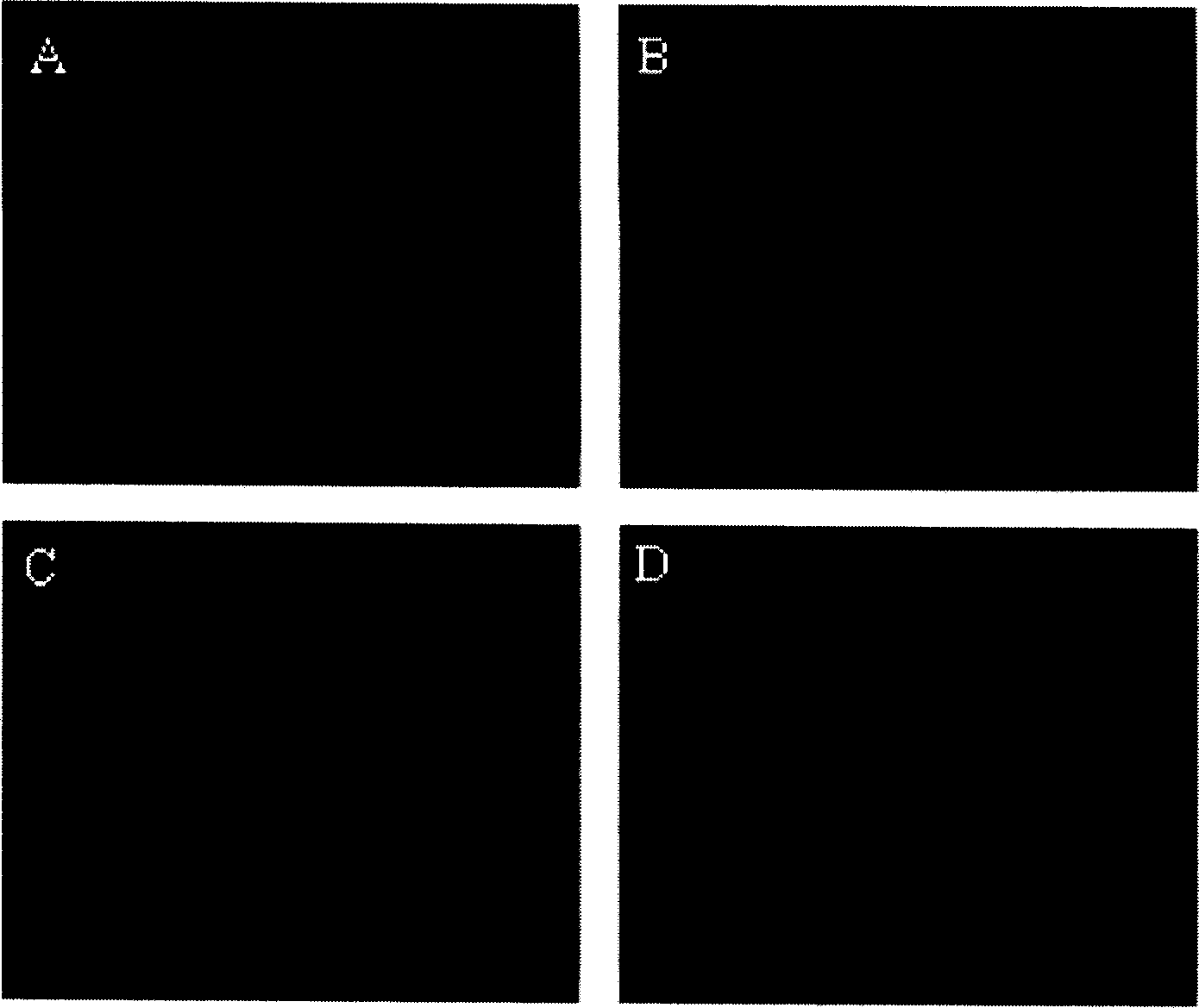 Application of musculus growth inhibin for preparing anticarcinogen