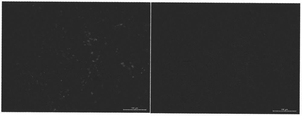 Preparation method of artificial skin with controllable drug release