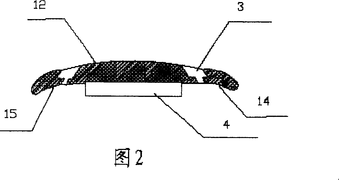 Vetebrae anterior biological osteogenesis-inducing type internal fixing device