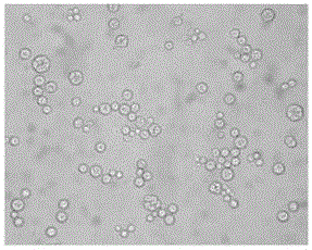 Schizochytrium limacinum suitable for high-density culture and method for producing grease rich in DHA