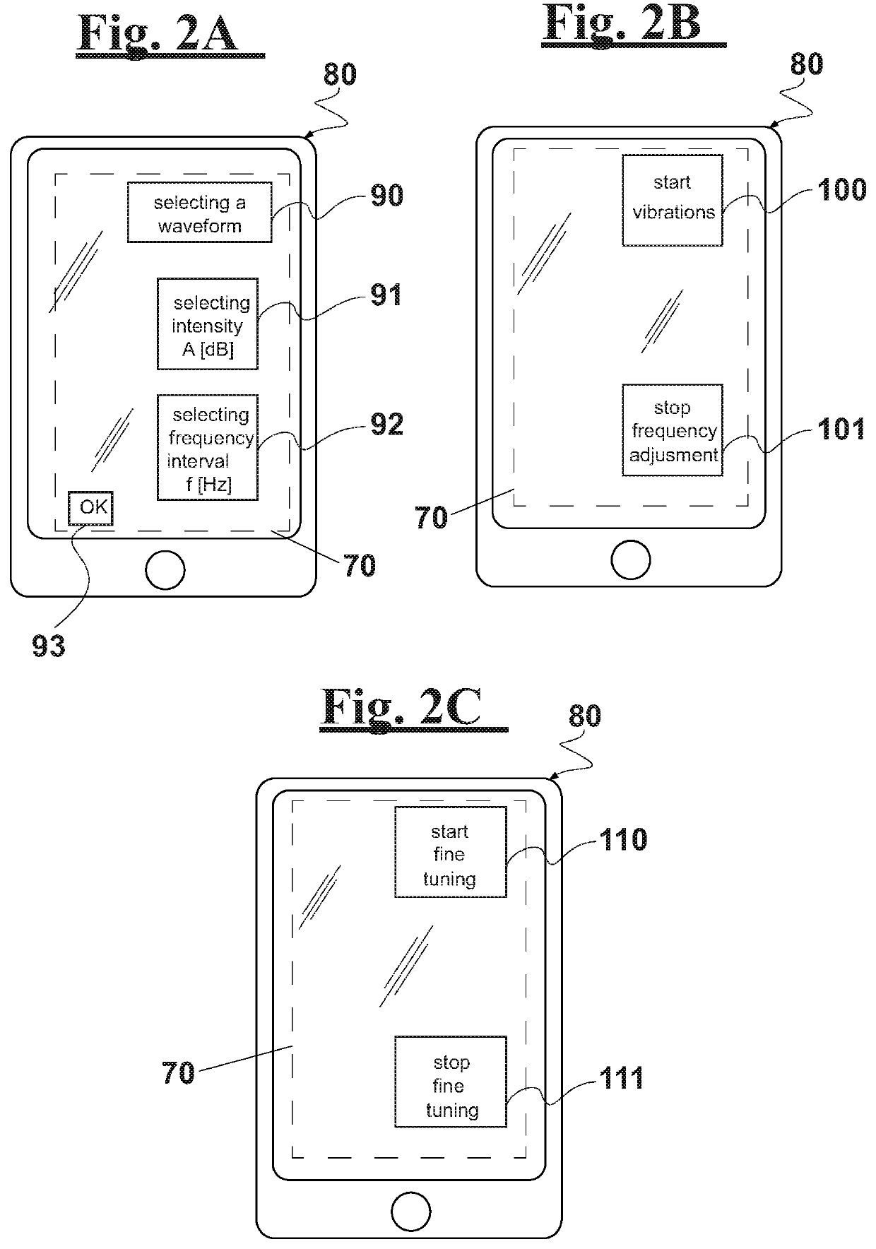 Electromechanical stimulation system for treating tinnitus