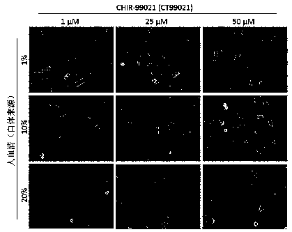 Preparation method and application of treatment-grade mesenchymal stem cells based on induced pluripotent stem cells