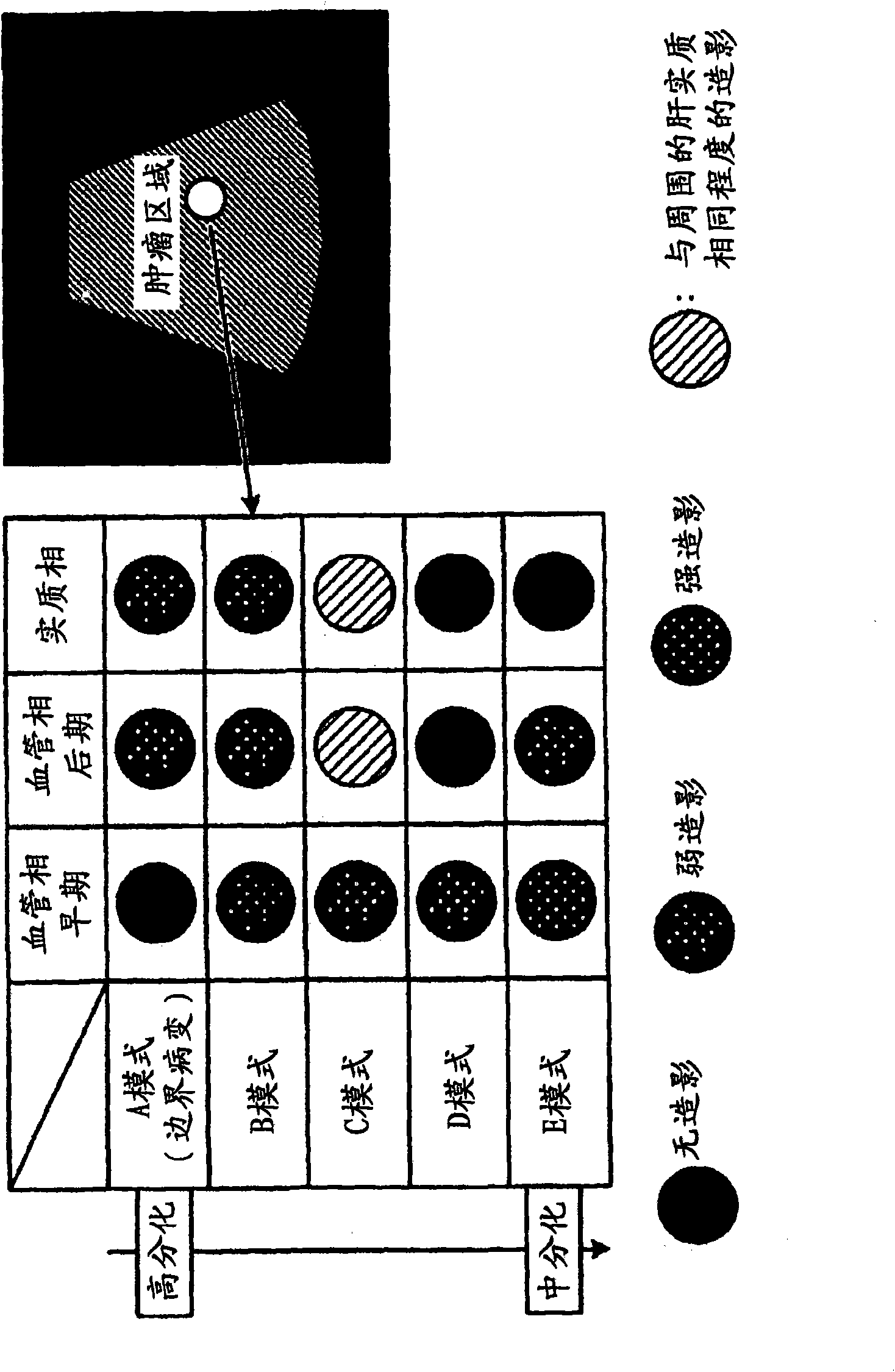 Medical image processing apparatus and ultrasonic imaging apparatus