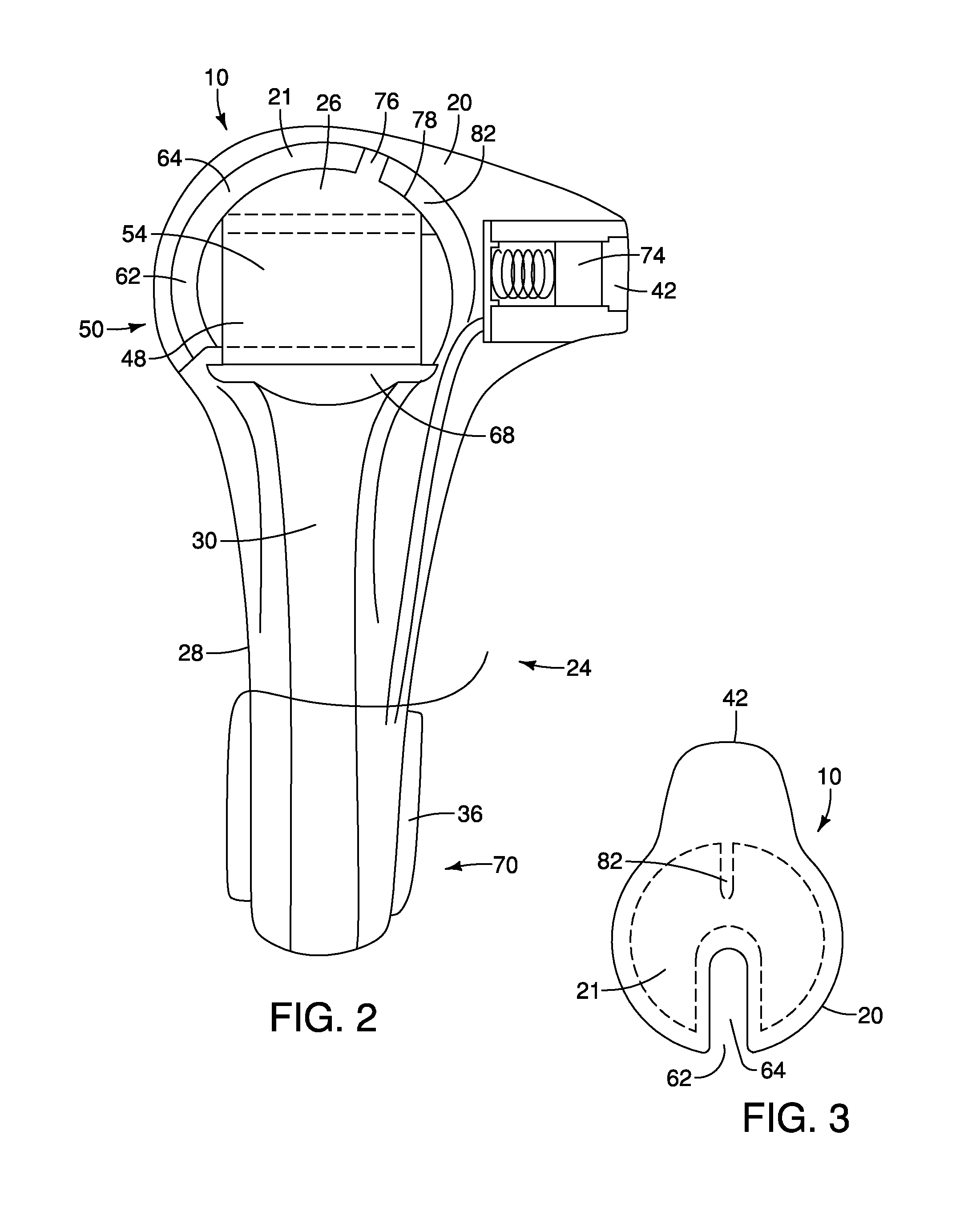 Low Profile Gastrostomy Tubes