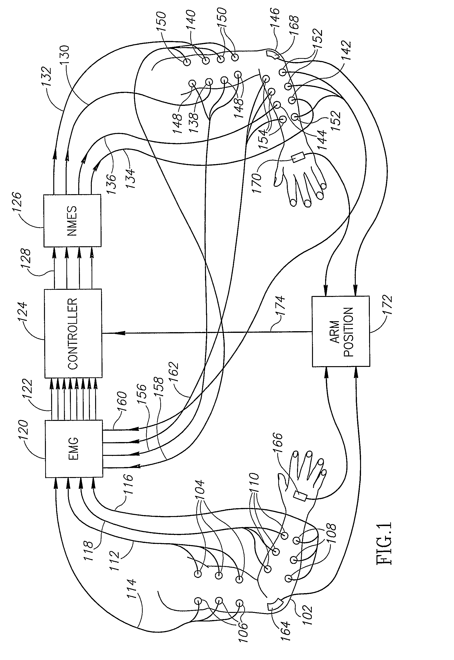 Neuromuscular stimulation