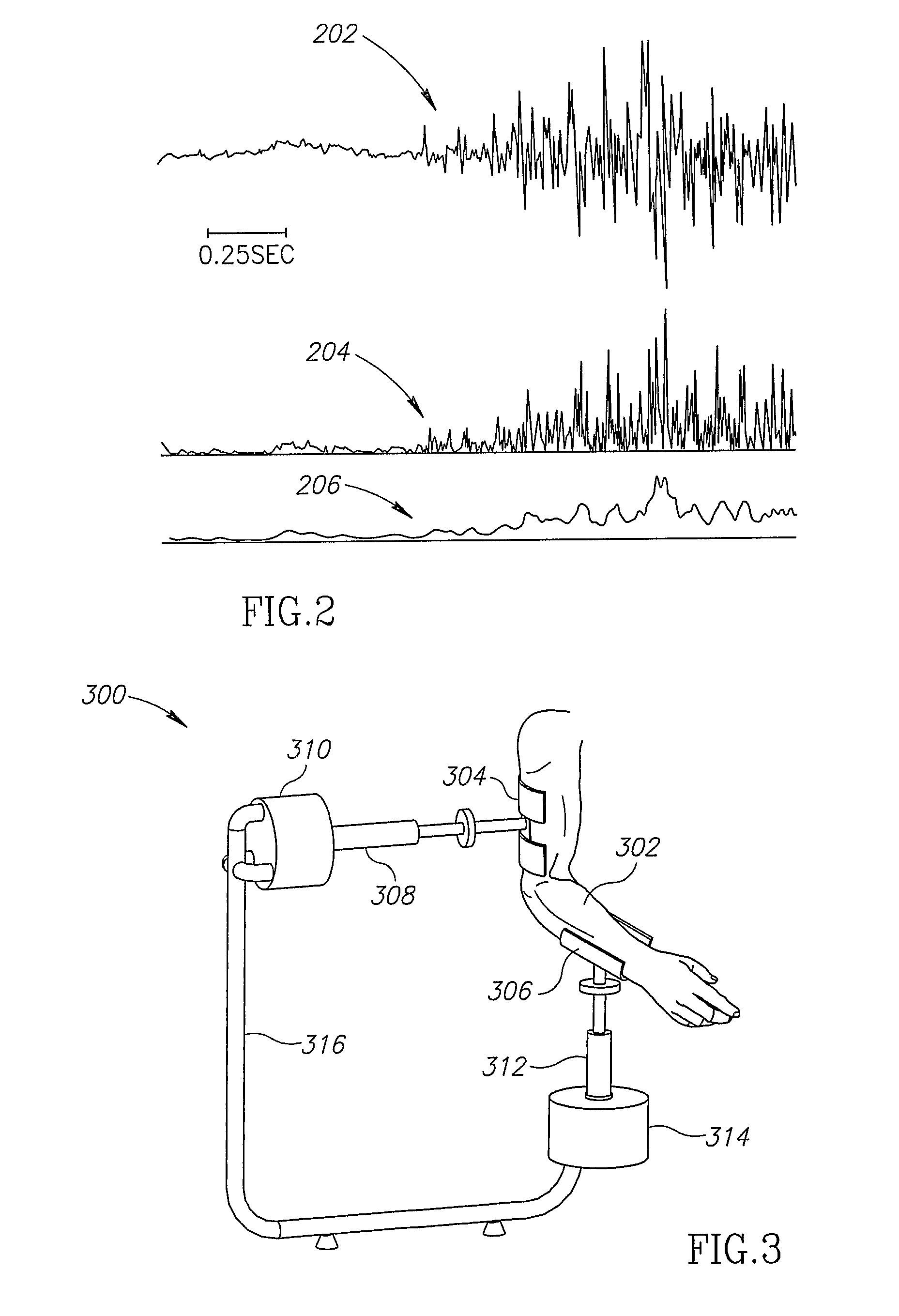 Neuromuscular stimulation