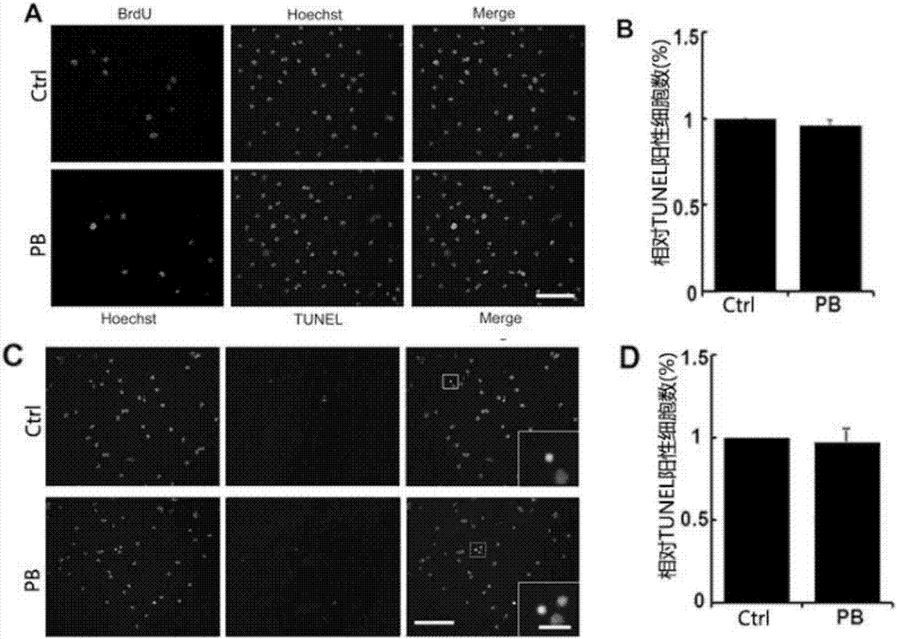 Application of pinocembrin to preparation of medicines for treating demyelination diseases