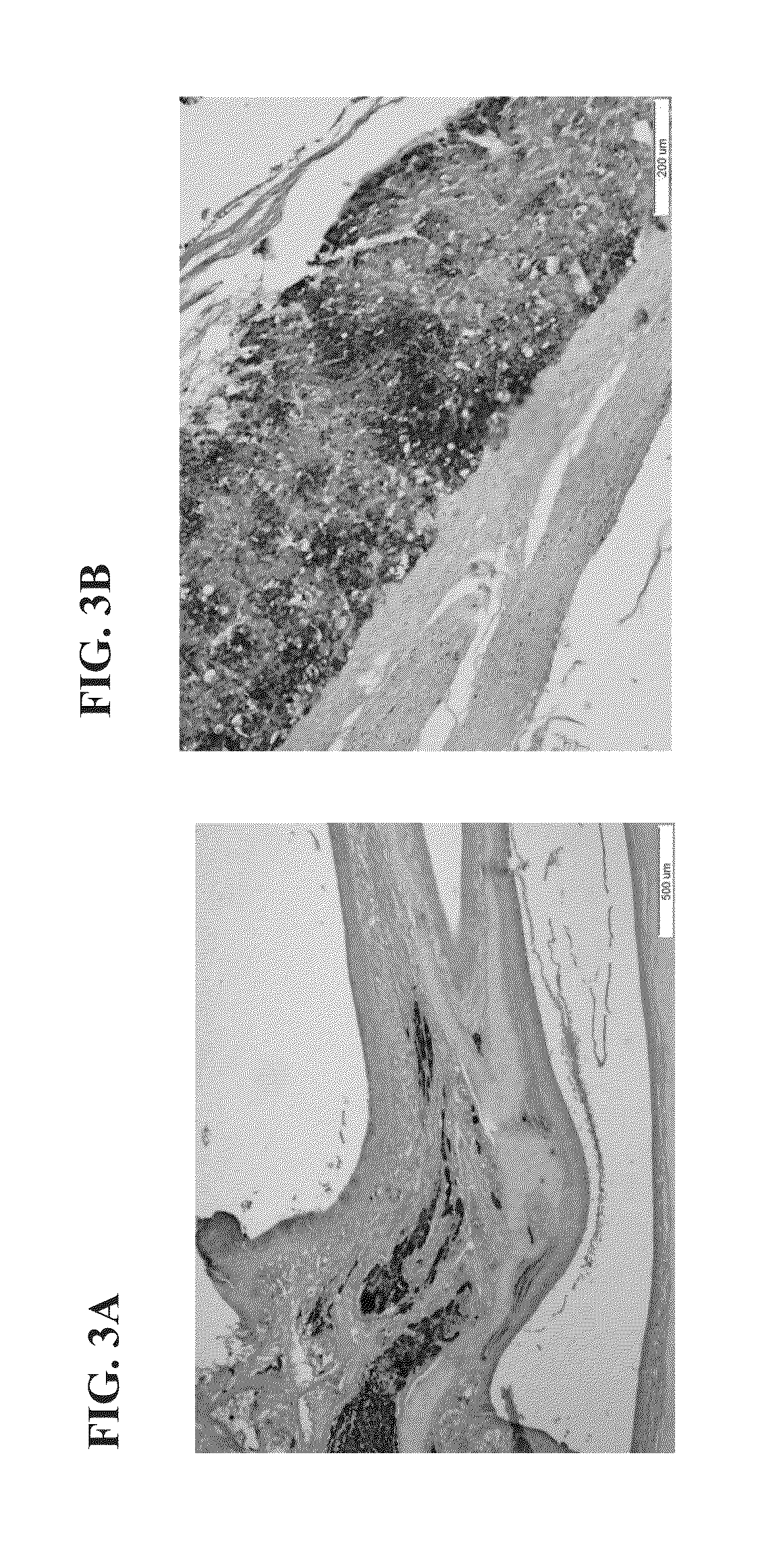 Transplantation of cells into the nasal cavity and the subarachnoid cranial space