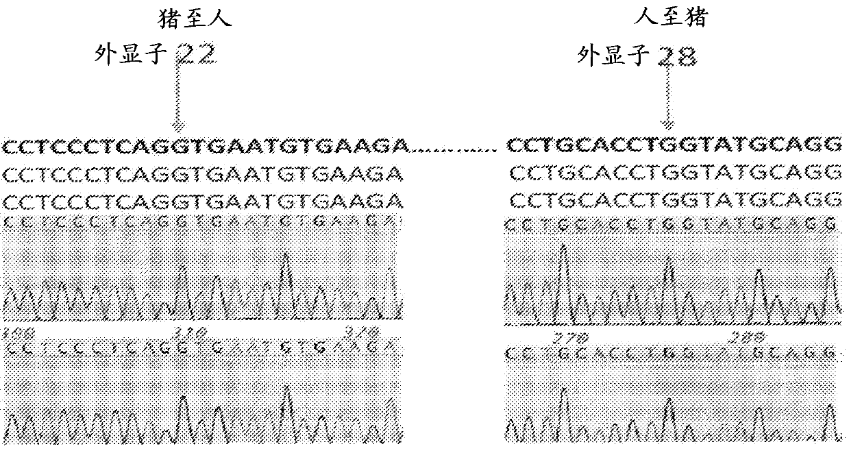 Multi-transgenic pig for xenotransplantation