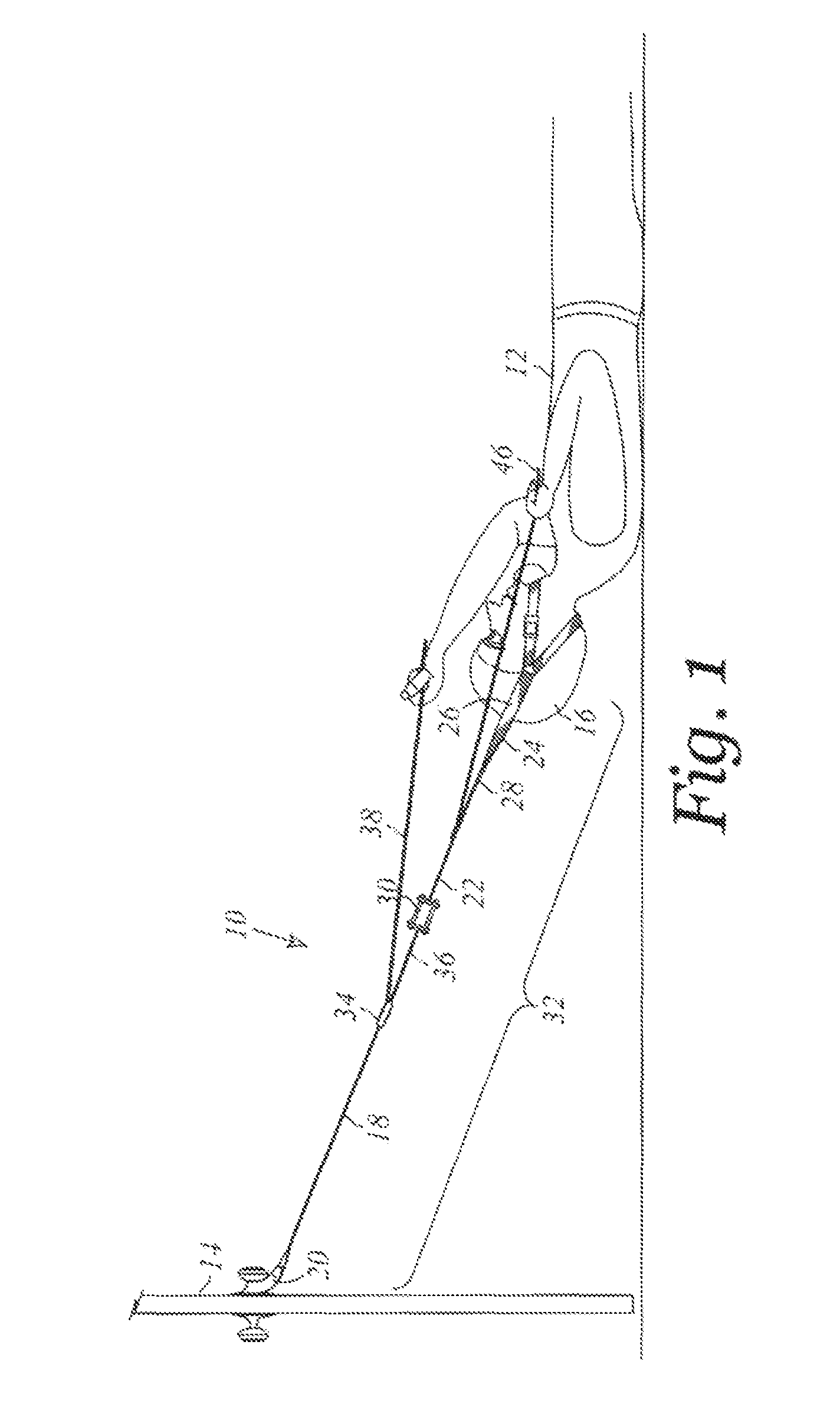 Spinal decompression device and method of use