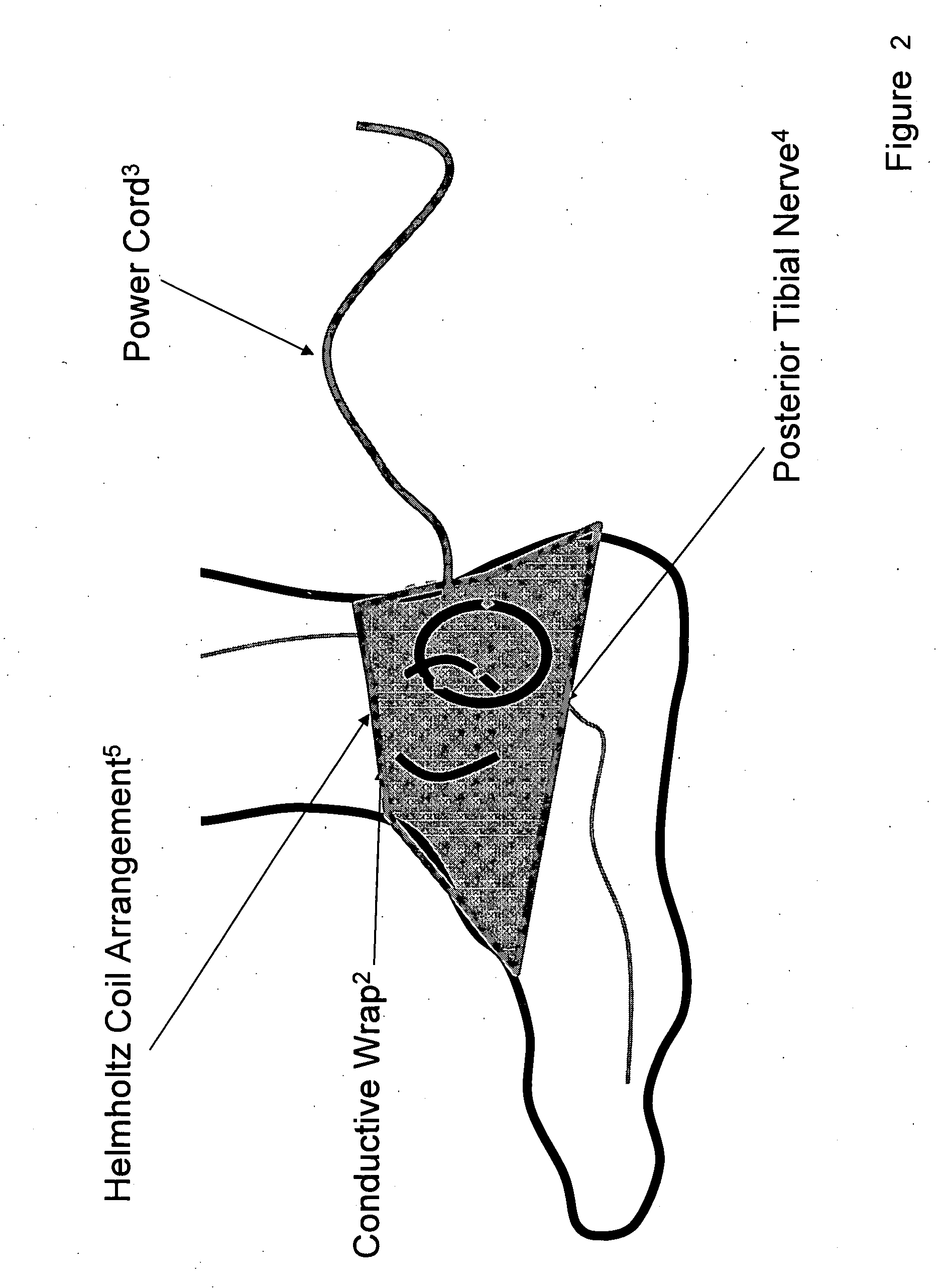 Method and apparatus for low frequency induction therapy for the treatment of urinary incontinence and overactive bladder