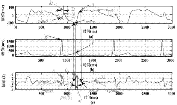 Method for extracting pulse waveform feature points