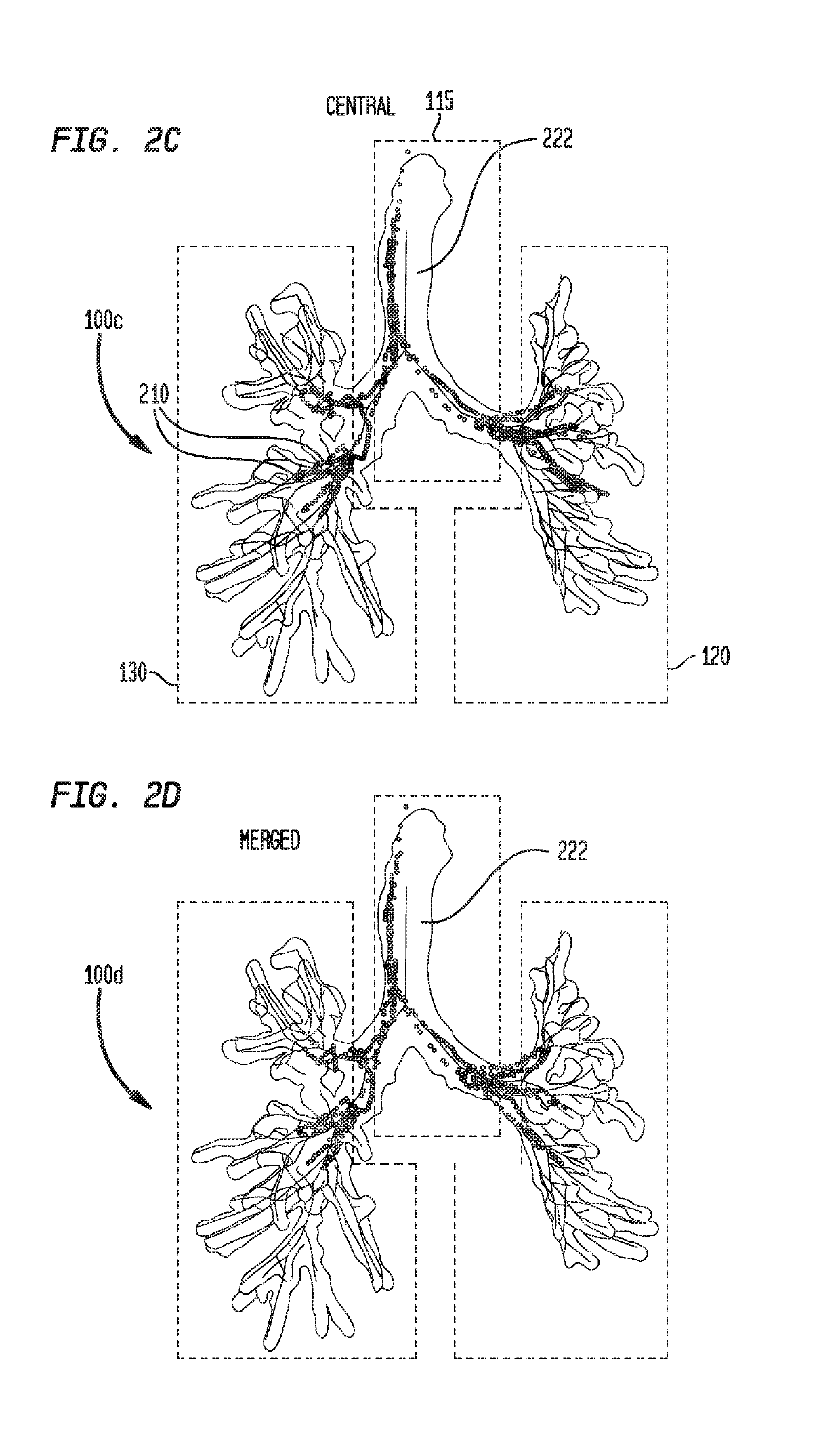 Multi-rigid registration of magnetic navigation to a computed tomography volume