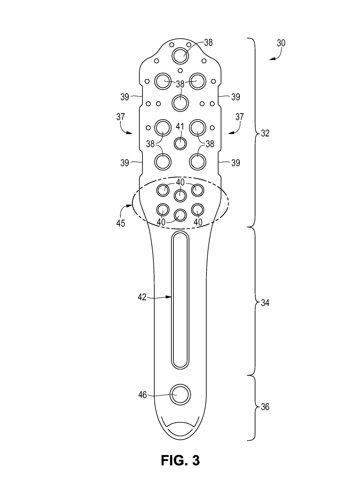 Fixation device for proximal humerus fractures