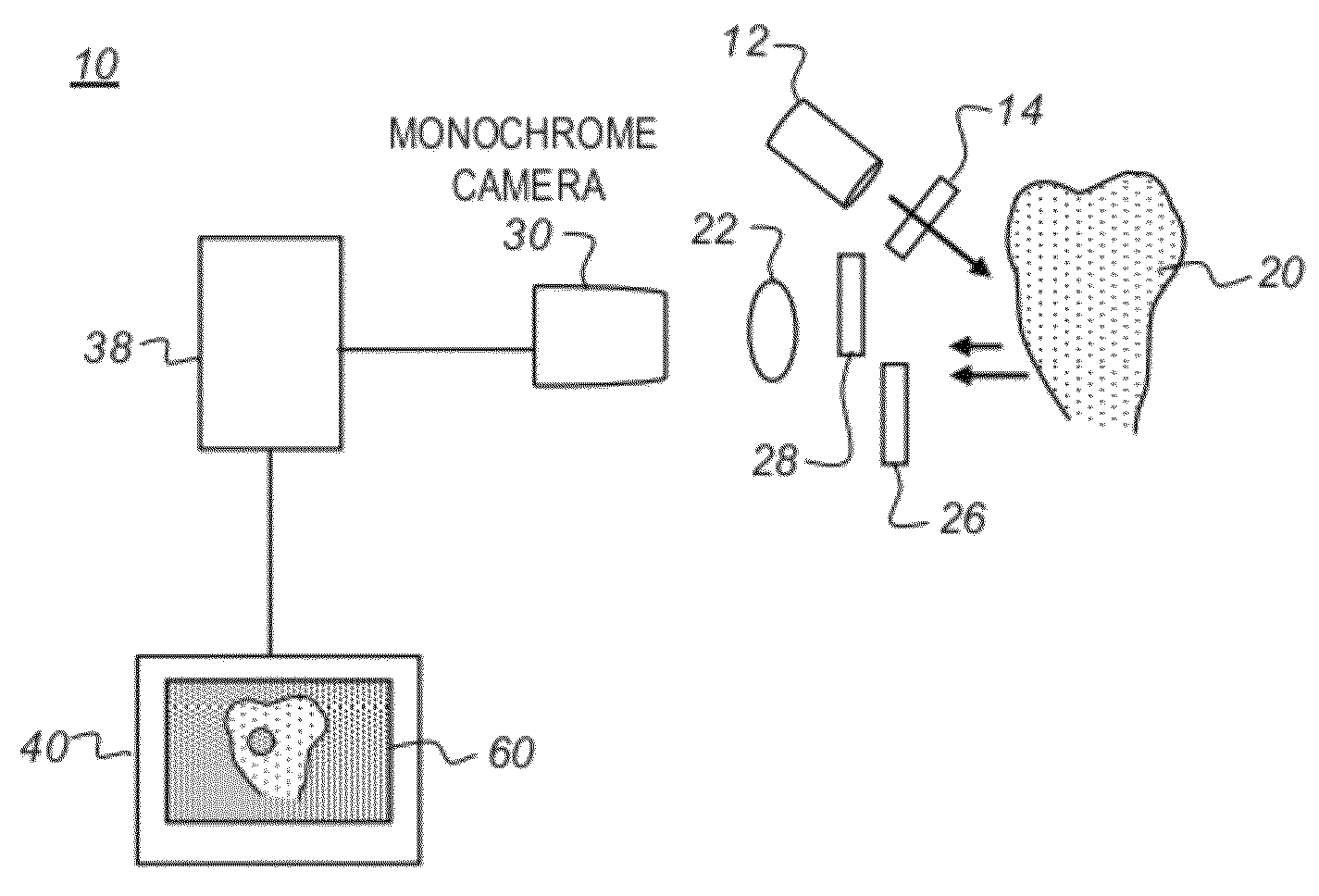 Apparatus for caries detection