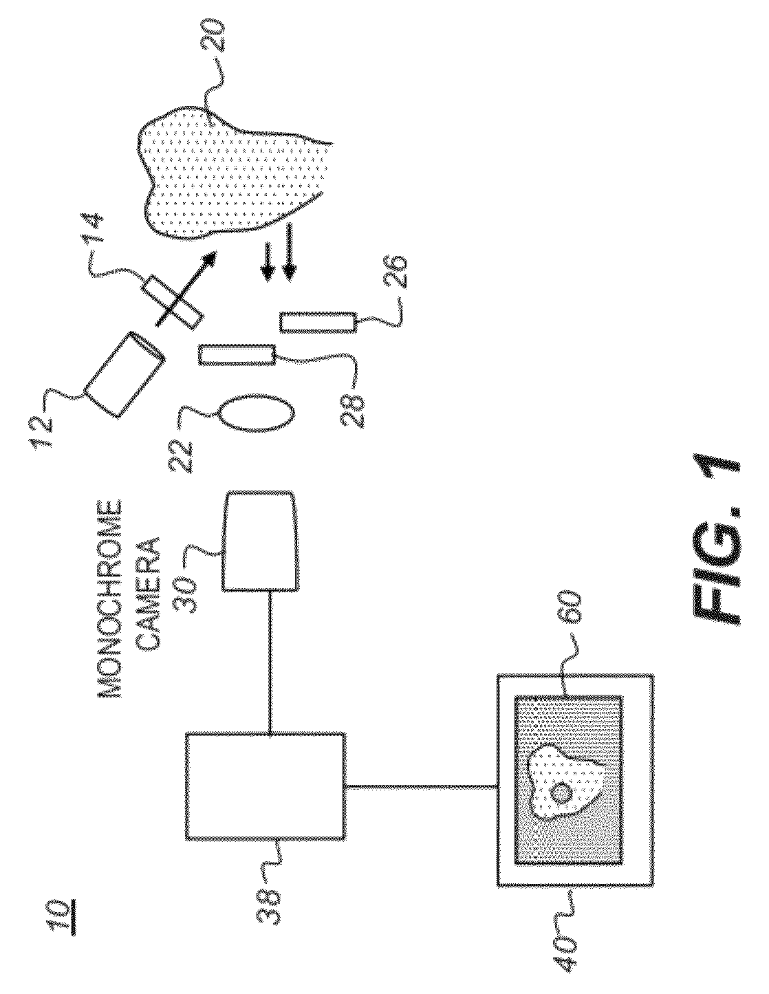 Apparatus for caries detection