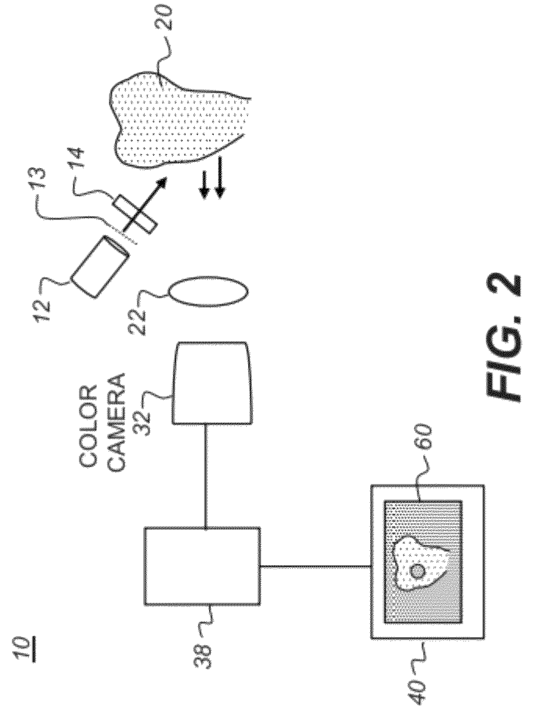 Apparatus for caries detection