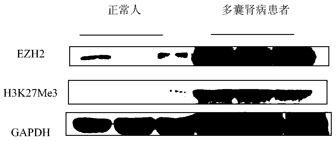 Application of EZH2 (enhancer of zeste homolog 2) in preparation of drugs to prevent or treat polycystic kidney disease