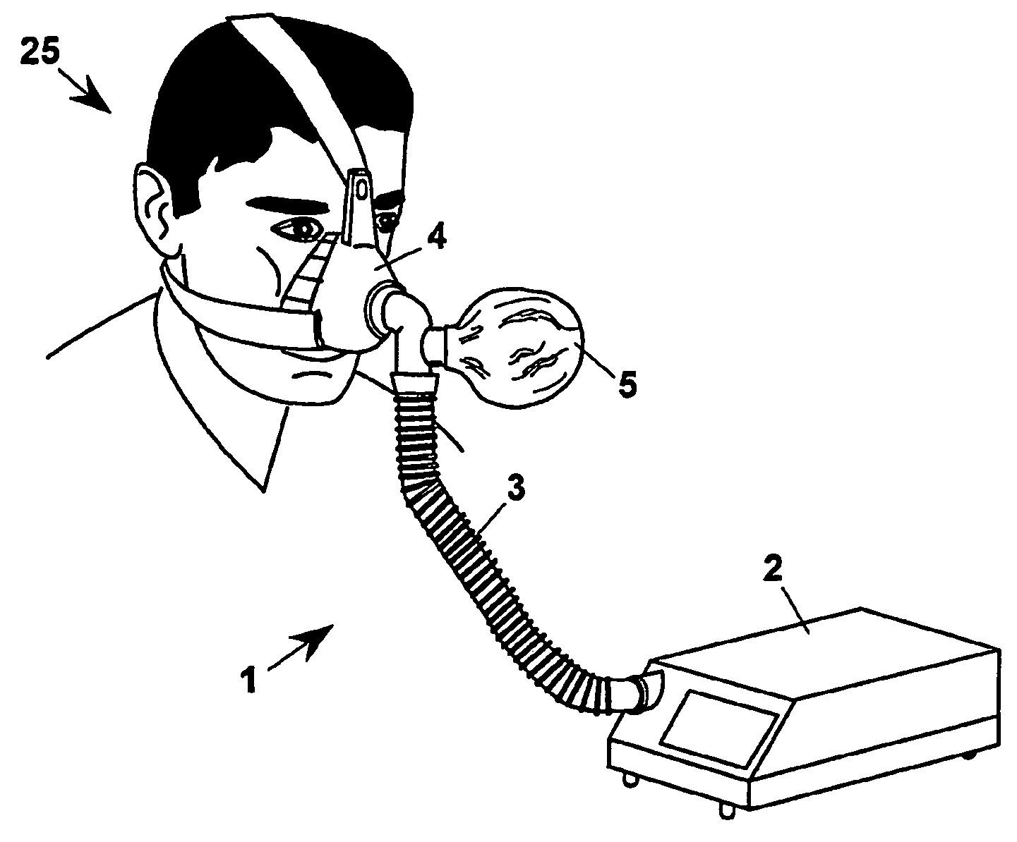 Apparatus for non-invasive mechanical ventilation