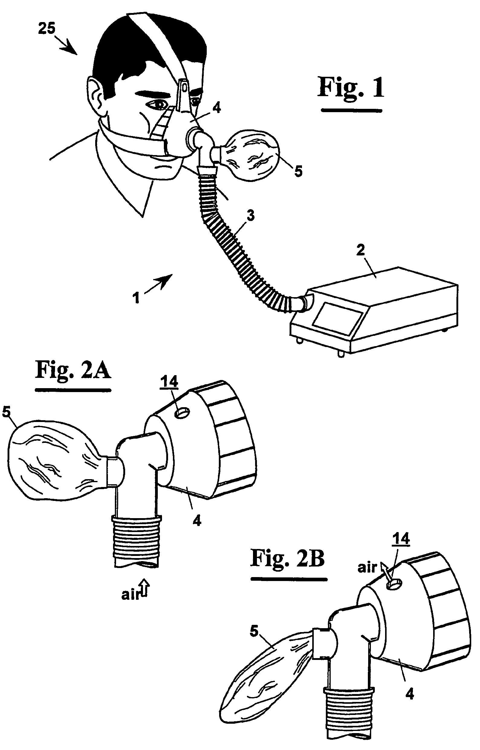 Apparatus for non-invasive mechanical ventilation