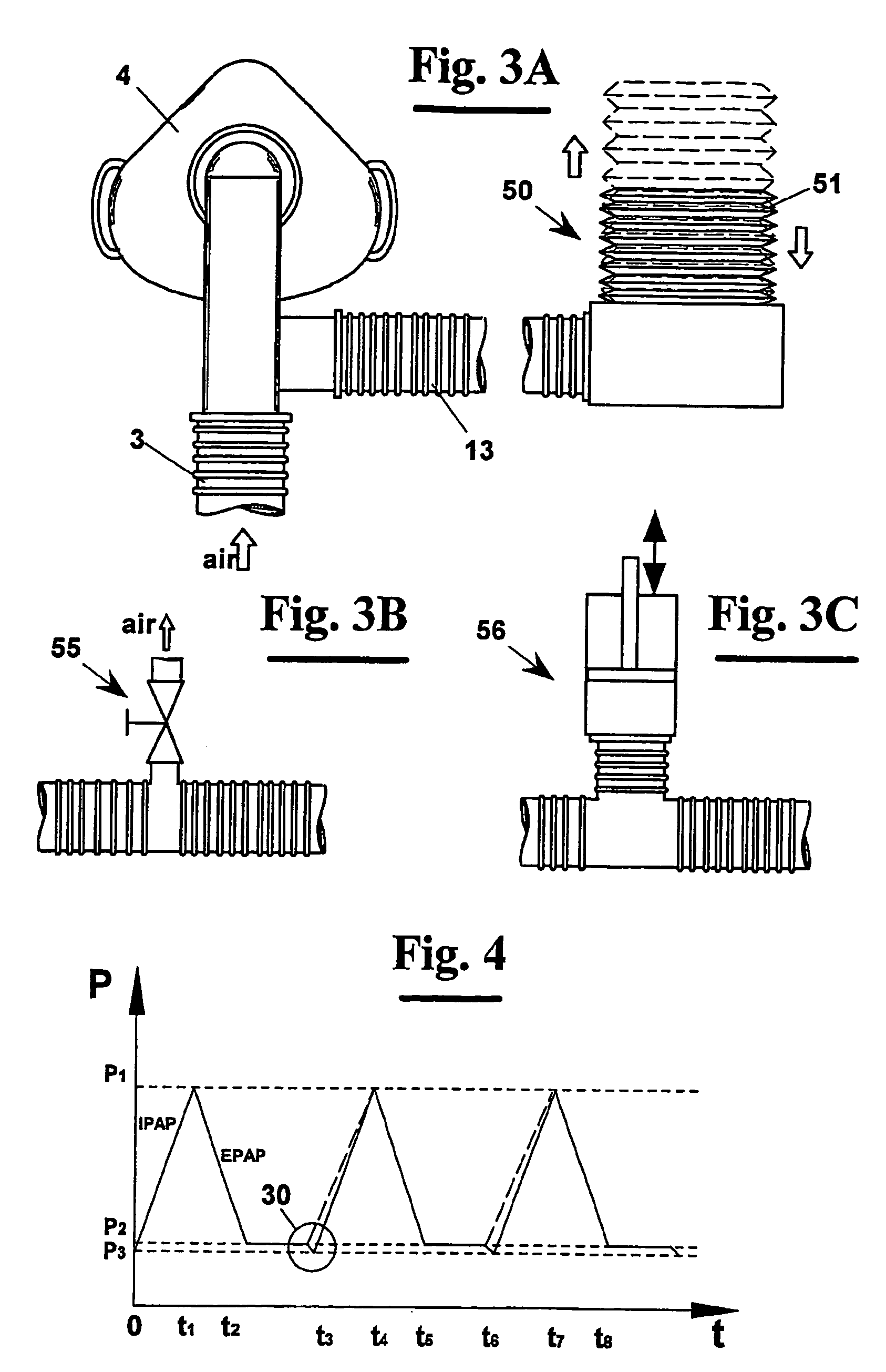 Apparatus for non-invasive mechanical ventilation