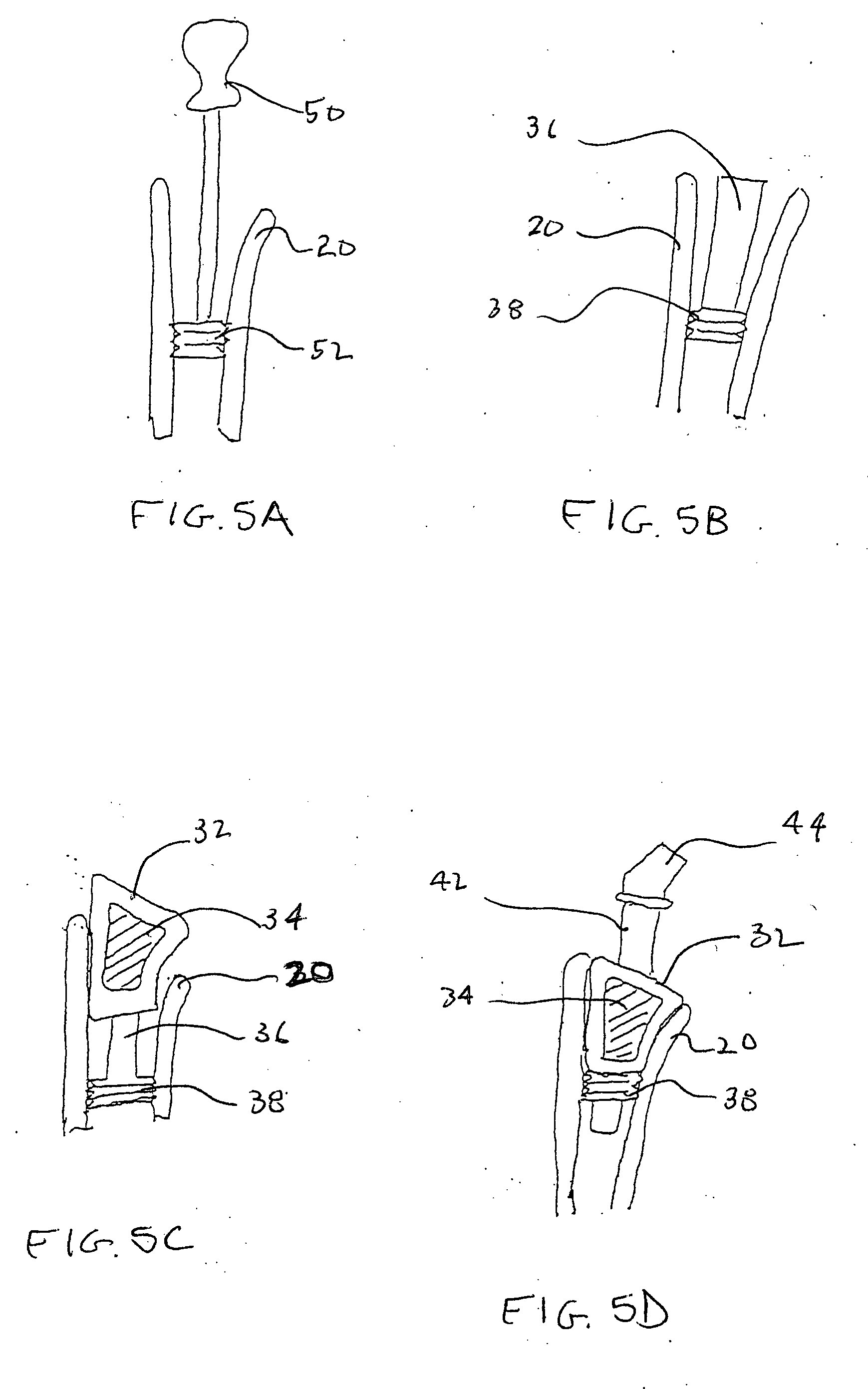 Arthroplasty devices configured to reduce shear stress