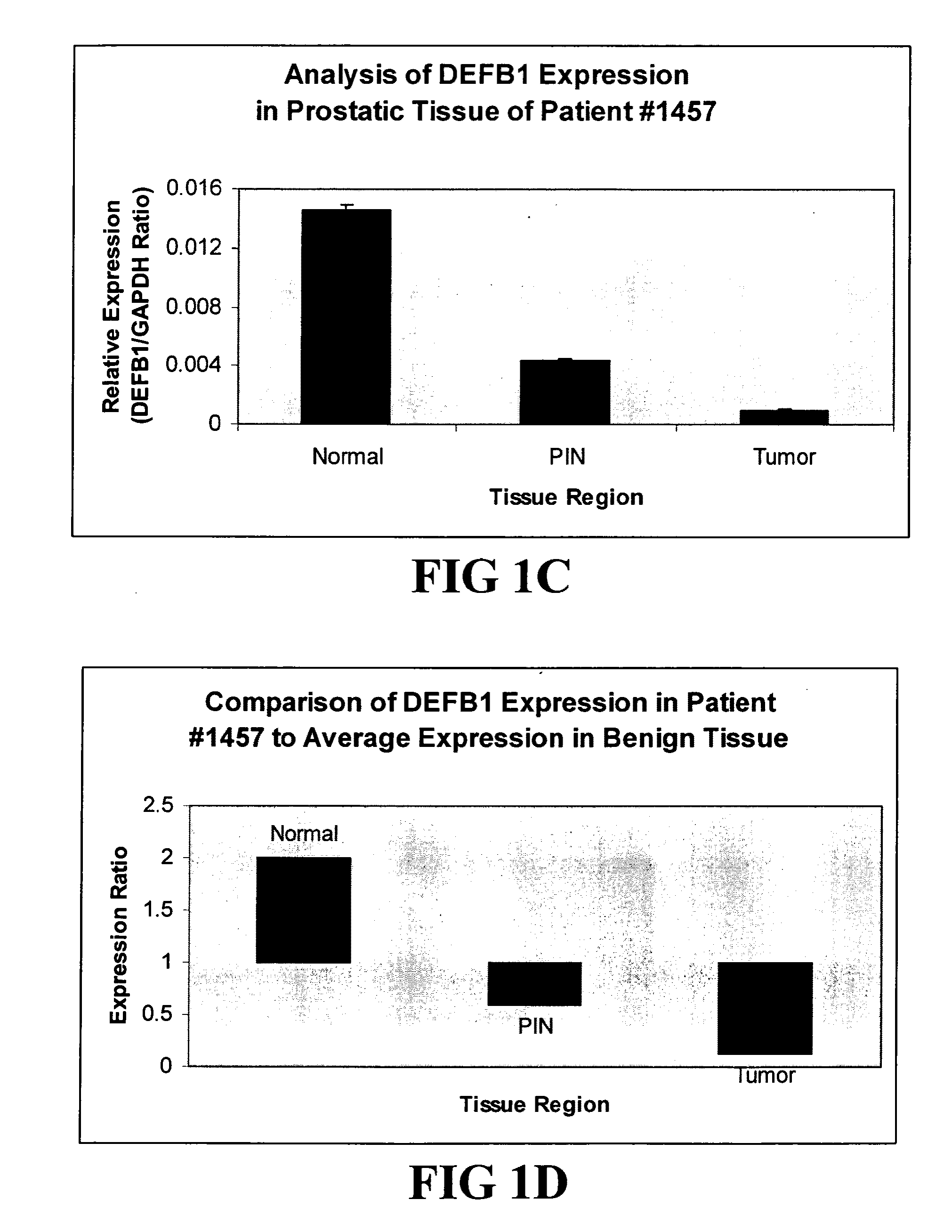 Compositions and methods for diagnosing, treating, and preventing prostate conditions