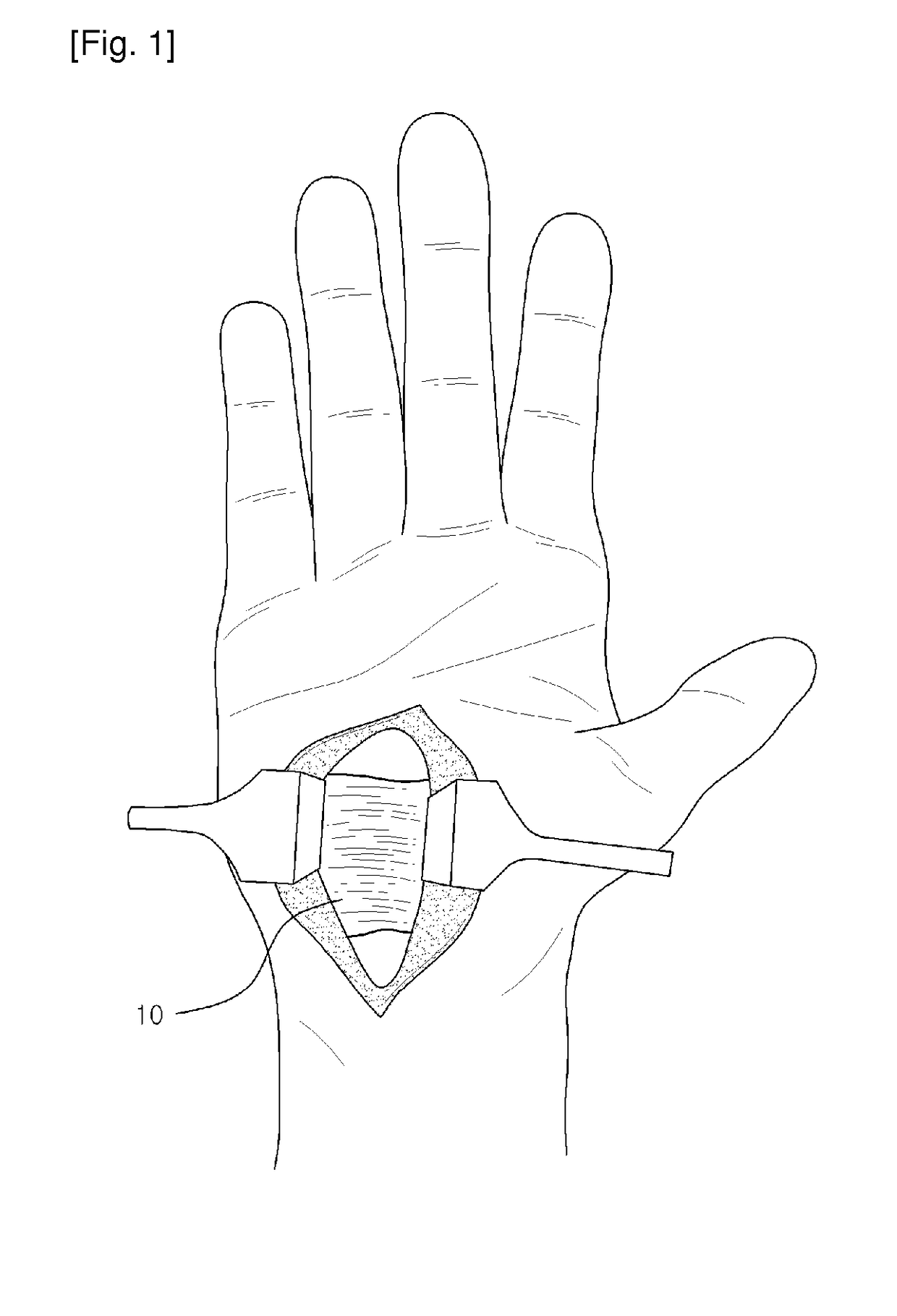 Surgical instrument, and medical kit for treating carpal tunnel syndrome