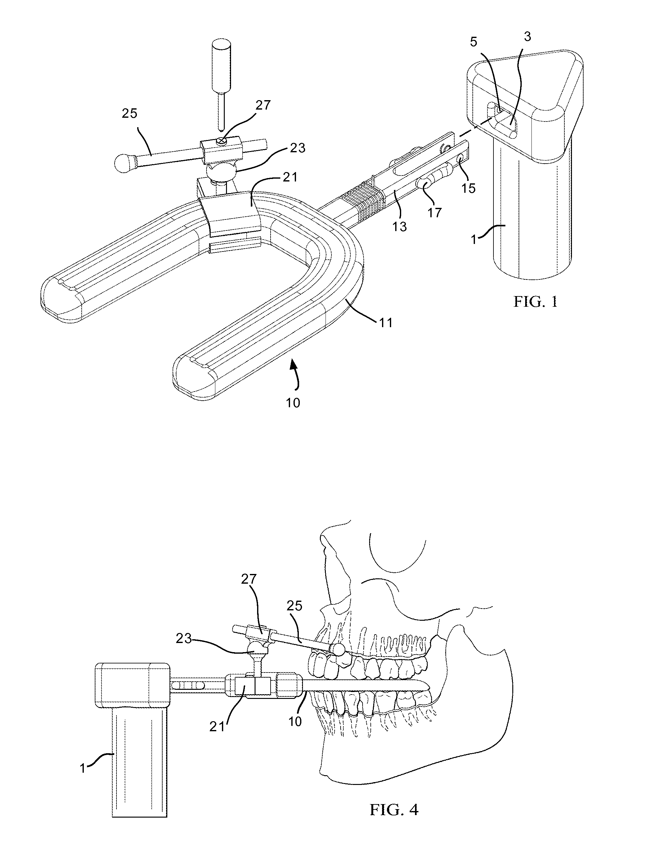 Vibrating dental plate and accessories