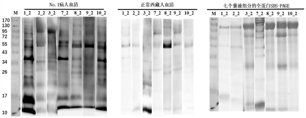 Neoantigen Cystatin protein for echinococcosis