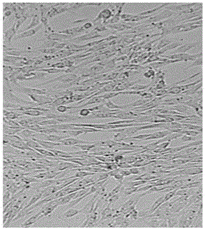 Preparation method for hair keratin-cell tissue composite engineered dressing