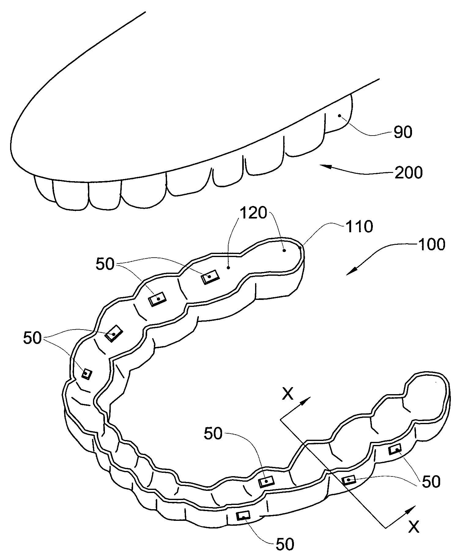 Dental targetting device and method