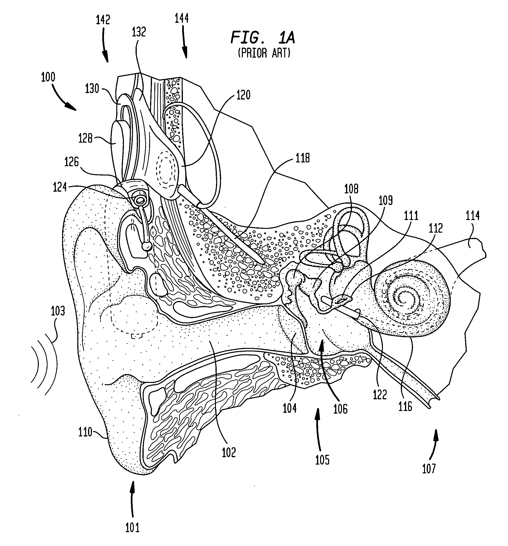 Cochlear endosteal electrode carrier member