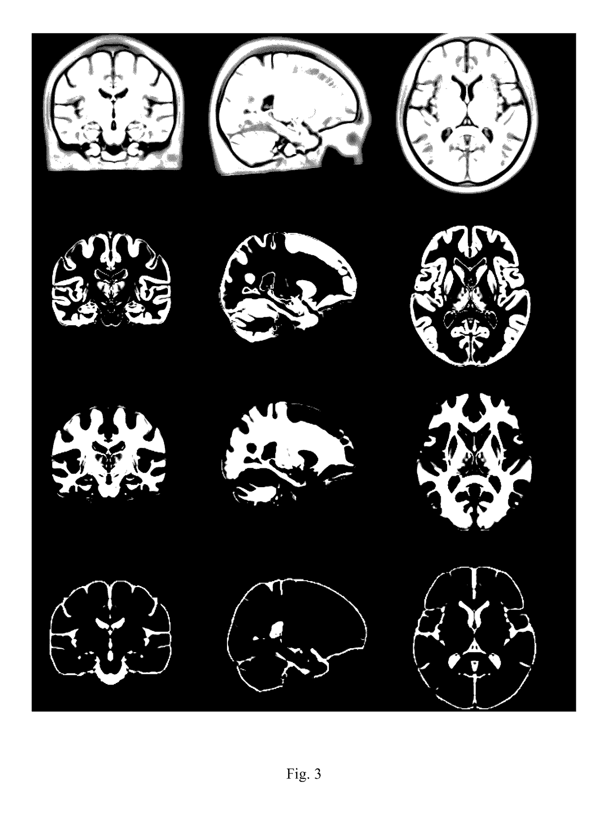 Method and device for constructing brain templates