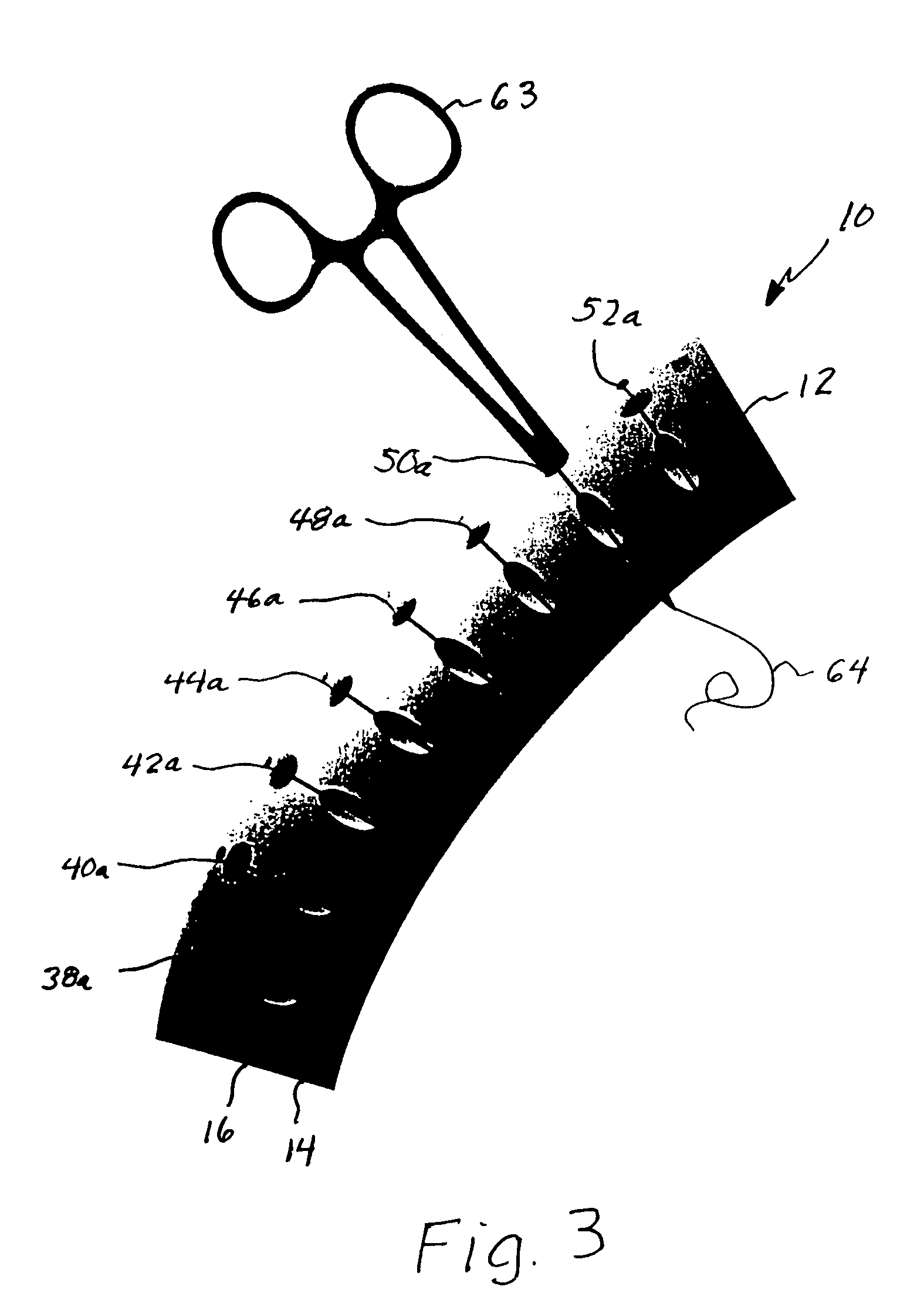 Suture and clamp retainer and organizer