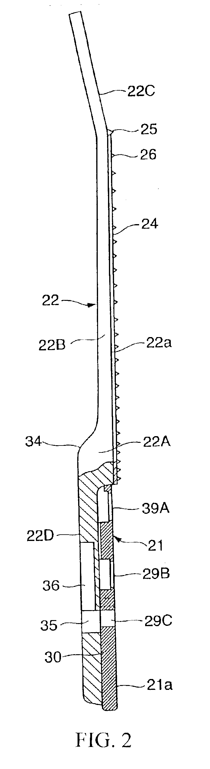 Body structure of guitar