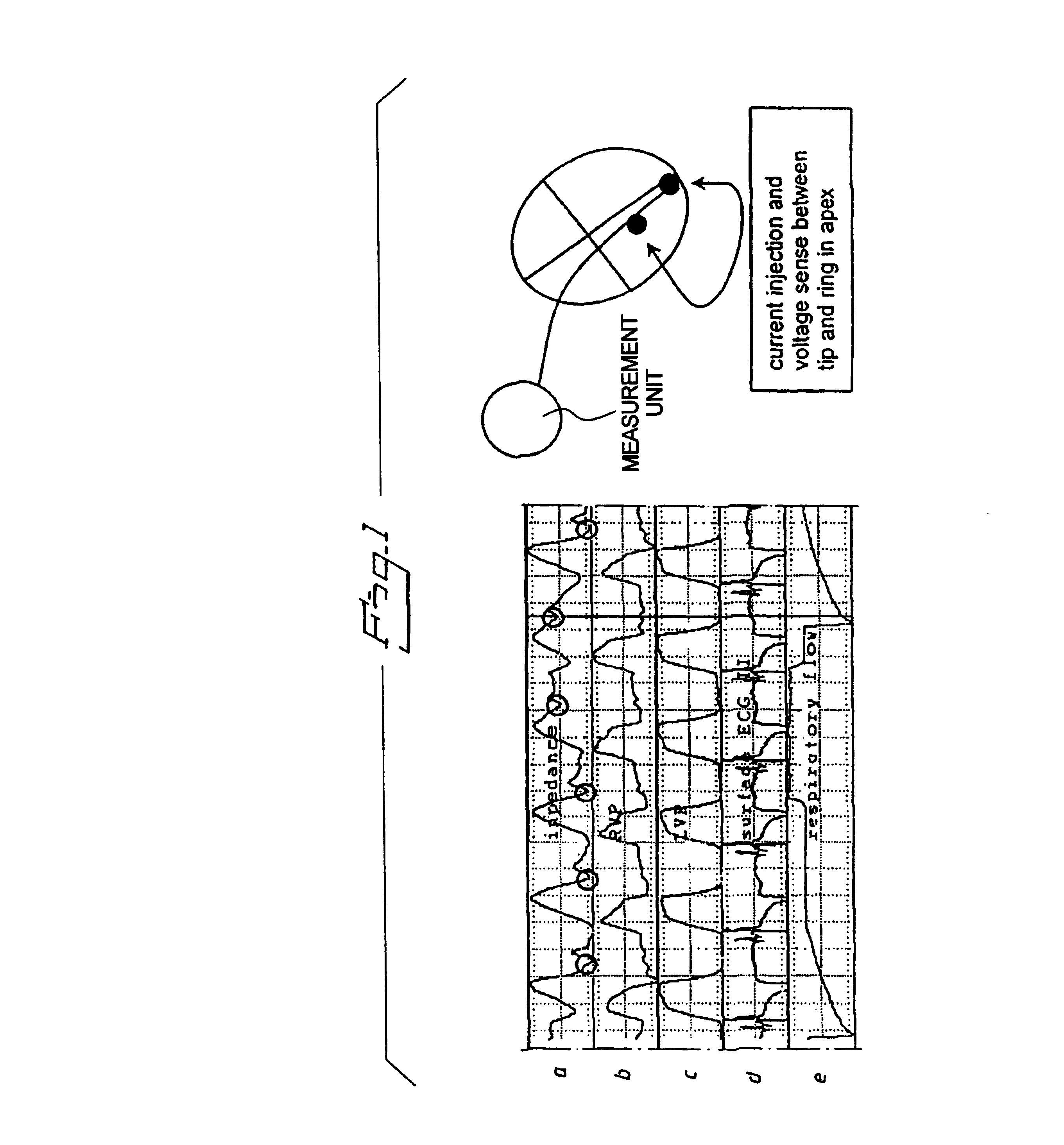 Method and monitor for monitoring diastolic relaxation of a heart ventricle